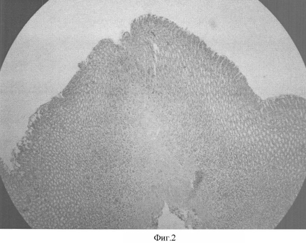 Способ моделирования аутоиммунного гастрита у крыс (патент 2356102)