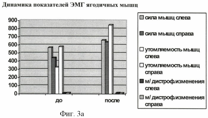 Способ лечения сочетанной деформации таза и позвоночника у детей (патент 2423095)