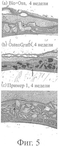 Способ приготовления заменителя костного трансплантата, не содержащего прионов (патент 2393819)