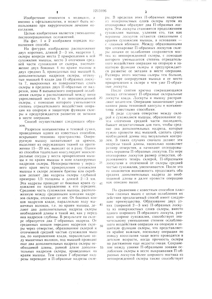 Способ хирургического лечения косоглазия (патент 1215696)
