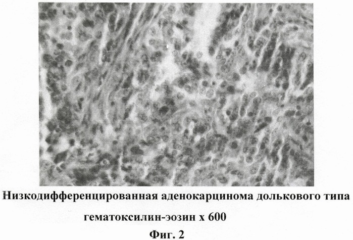 Способ профилактики канцерогенного действия метилнитрозомочевины у экспериментальных животных (патент 2410114)