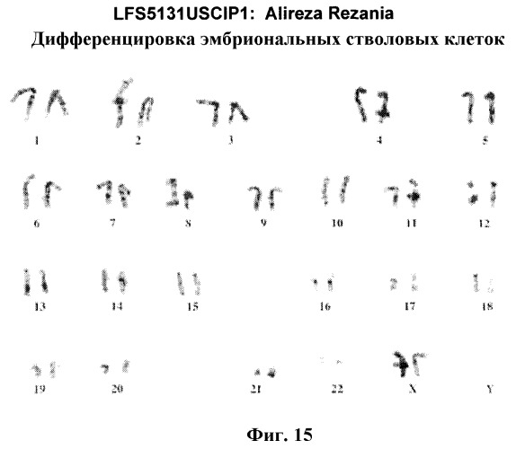 Дифференцировка эмбриональных стволовых клеток человека (патент 2465323)