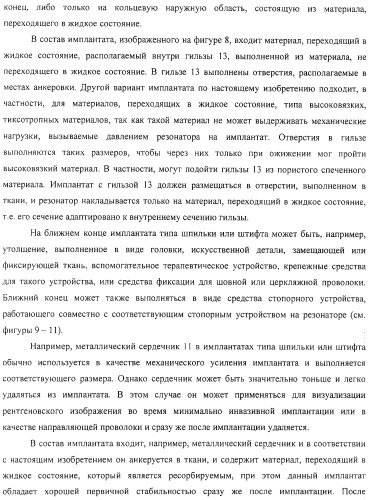 Имплантаты для создания соединений с тканями, в частности со скелетом, а также устройство и способ имплантации (патент 2314768)
