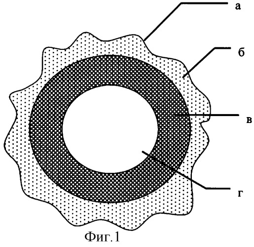Способ реконструкции магистральных артериальных сосудов при их атеросклеротическом поражении (патент 2311139)