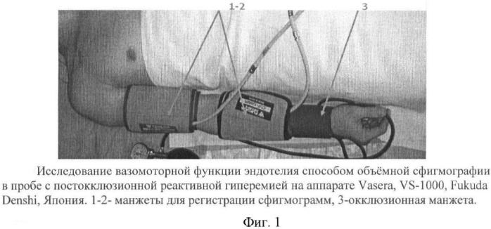 Способ оценки вазомоторной функции эндотелия с применением объемной сфигмографии (патент 2428924)