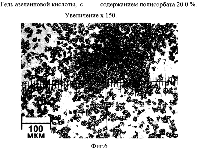 Стабильная гелевая форма азелаиновой кислоты (патент 2557932)