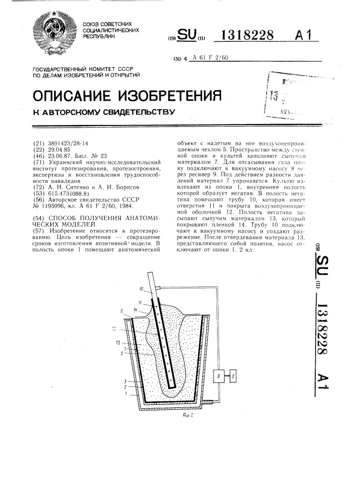 Способ получения анатомических моделей (патент 1318228)