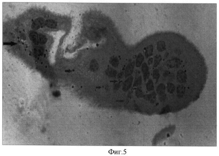 Способ диагностики внутриутробного инфицирования у матерей с урогенитальным хламидиозом (патент 2400755)
