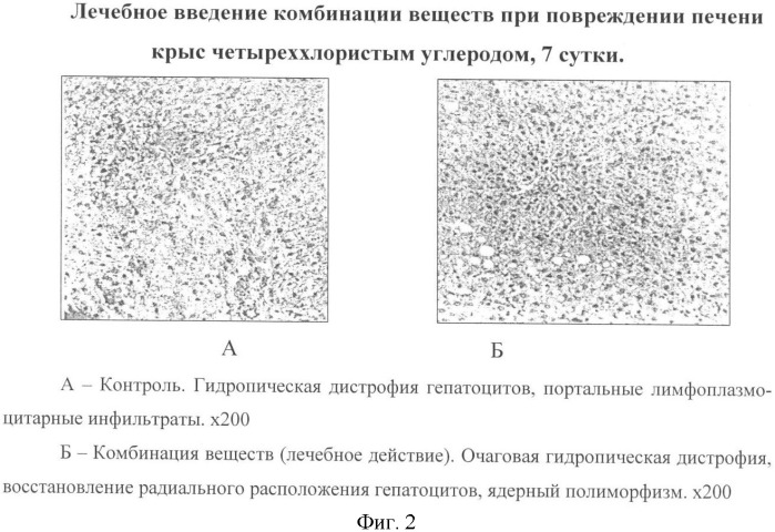 Способ уменьшения токсического повреждения печени (патент 2342132)
