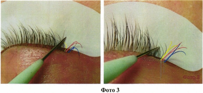 Способ наращивания ресниц "lash-to-lash" (патент 2541953)