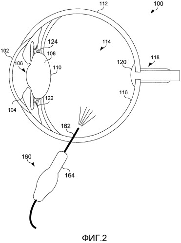 Офтальмологическая эндоиллюминация с использованием света, генерируемого волокном (патент 2526423)