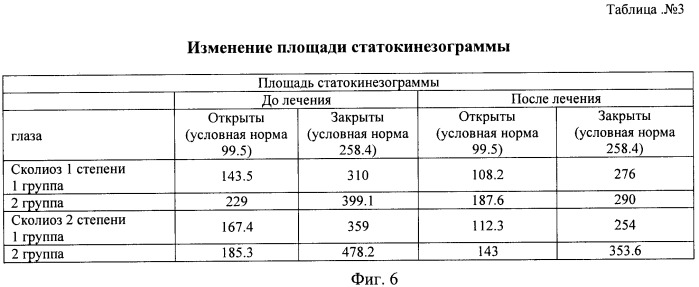 Способ лечения сочетанной деформации таза и позвоночника у детей и устройство для его осуществления (патент 2448667)