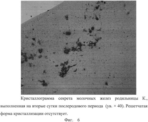 Способ прогнозирования ранней гипогалактии (патент 2563136)