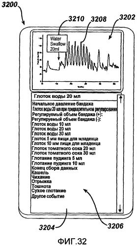 Анализ физиологических параметров для имплантируемого устройства ограничения и регистрирующего устройства (патент 2501519)