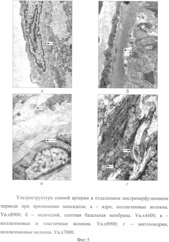 Способ коррекции структурных перестроек сосудов в эксперименте (патент 2349320)