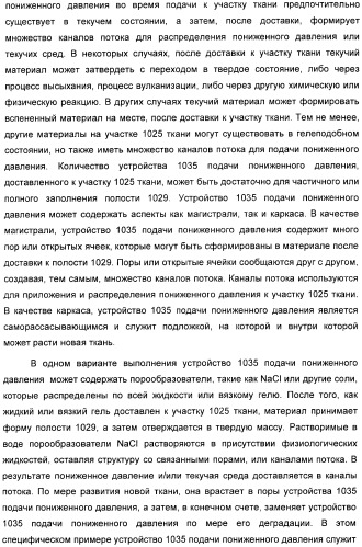 Устройство для лечения путем подкожной подачи пониженного давления с использованием разделения с помощью воздушного баллона (патент 2401652)