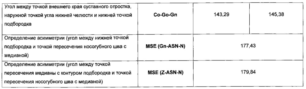 Способ моделирования костно-реконструктивных операций при лечении новообразований челюстных костей в детском возрасте (патент 2607651)