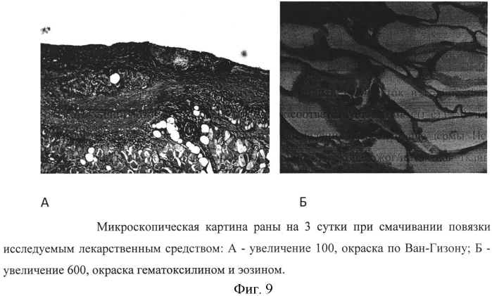 Средство для лечения ожогов и ран на основе цитокинов и факторов роста, секретируемых мезенхимными клетками человека, способ получения средства и способ лечения ожогов и ран (патент 2574017)