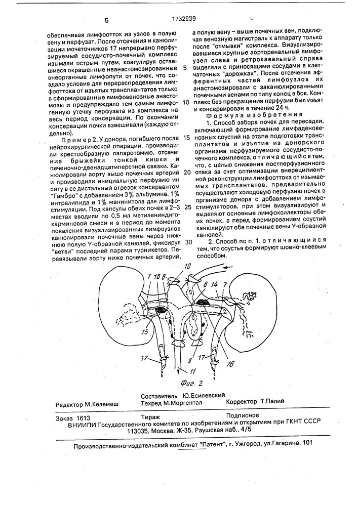 Способ забора почек для пересадки (патент 1732939)