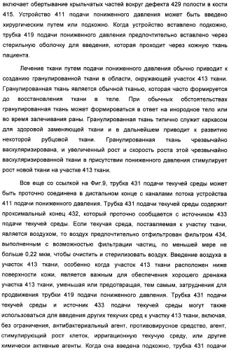 Устройство для лечения путем подкожной подачи пониженного давления с использованием текучей магистрали и связанный с ним способ (патент 2405459)