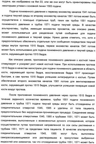 Устройство для лечения путем подкожной подачи пониженного давления с использованием текучей магистрали и связанный с ним способ (патент 2405459)