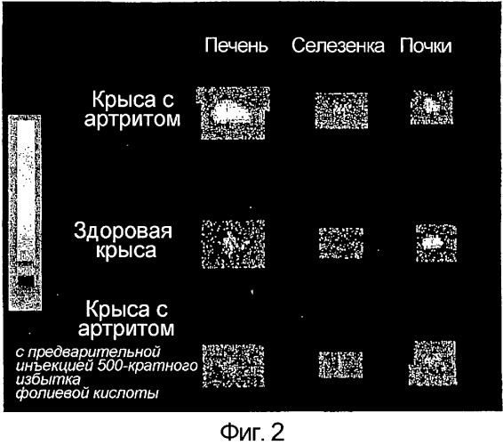 Лечение и диагностика заболеваний, опосредованных макрофагами (патент 2316349)