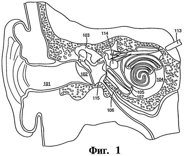 Система связи с внутренним ухом (патент 2465876)
