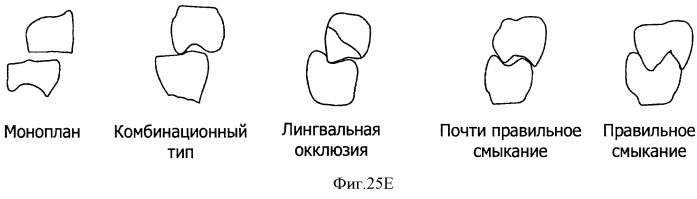 Зубные протезы, зубные дуги и способы их изготовления (патент 2510252)