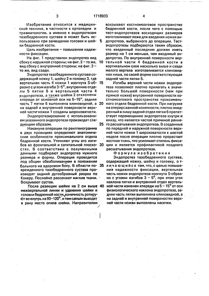 Эндопротез тазобедренного сустава (патент 1718903)