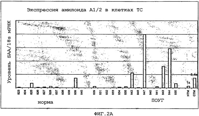 Применение гена сывороточного амилоида а в диагностике и лечении глаукомы и определении антиглаукоматозных средств (патент 2365379)