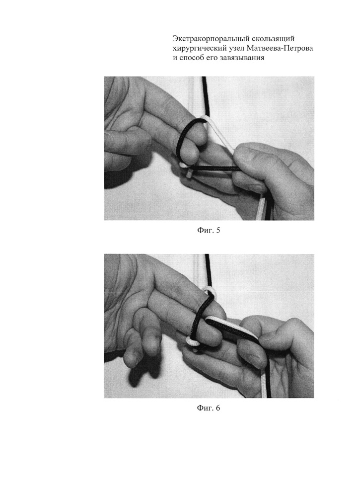 Экстракорпоральный скользящий хирургический узел матвеева-петрова и способ его завязывания (патент 2619751)