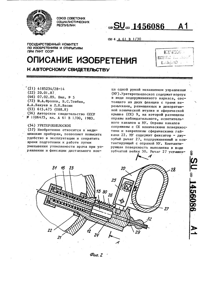 Уретеропиелоскоп (патент 1456086)