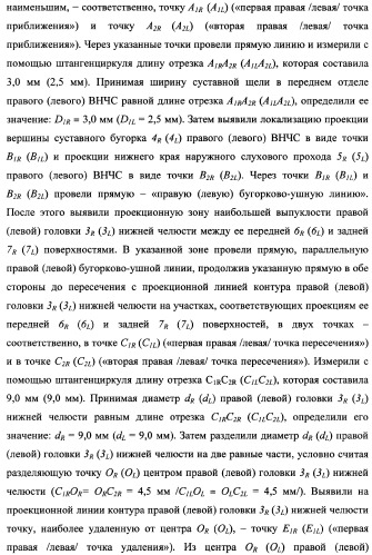 Способ определения оптимальной высоты прикуса (патент 2354300)