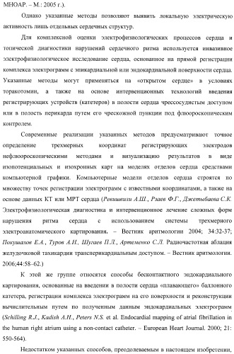 Способ неинвазивного электрофизиологического исследования сердца (патент 2417051)