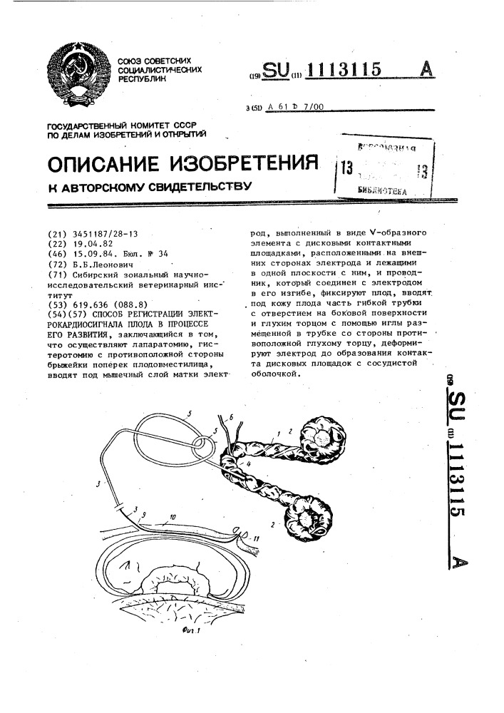 Способ регистрации электрокардиосигнала плода в процессе его развития (патент 1113115)