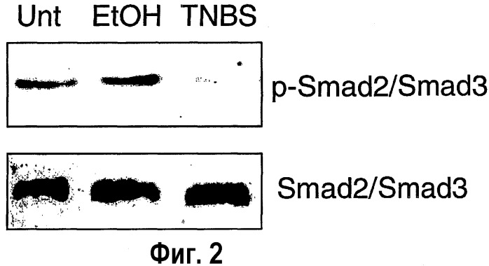 Антисмысловые олигонуклеотиды (odn) к smad7 и их применение в области медицины (патент 2339697)