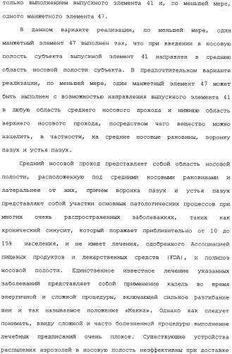 Носовое устройство (патент 2319513)