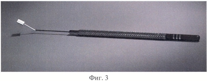 Устройство для измерения величины лагофтальма и глазной щели (патент 2391895)