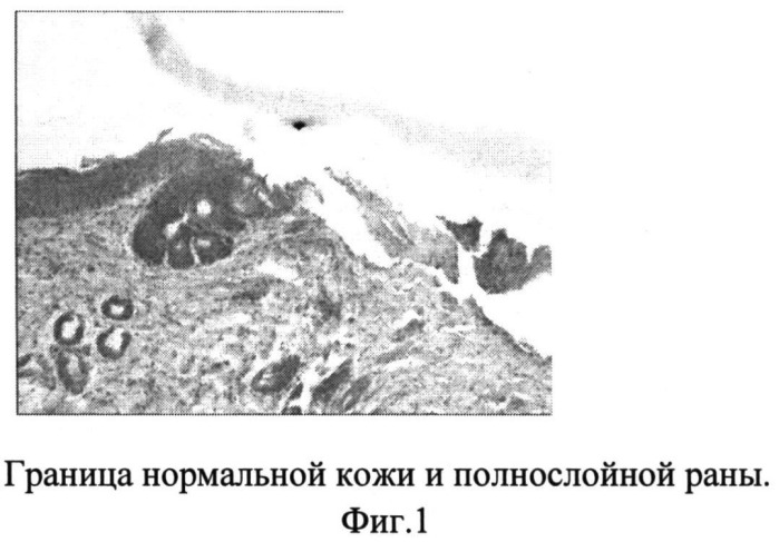 Способ повышения трансдермальной проницаемости лечебных или косметических препаратов для наружного применения, способ введения в кожу газообразного ксенона (патент 2506944)