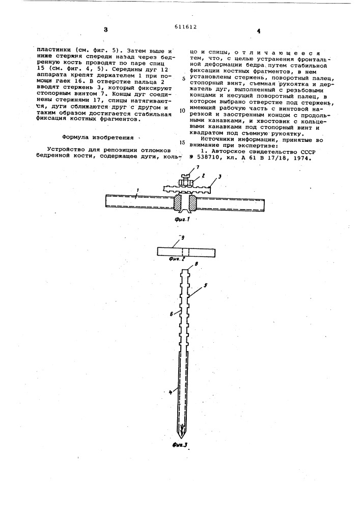 Устройство для репозиции отломков бедренной кости (патент 611612)