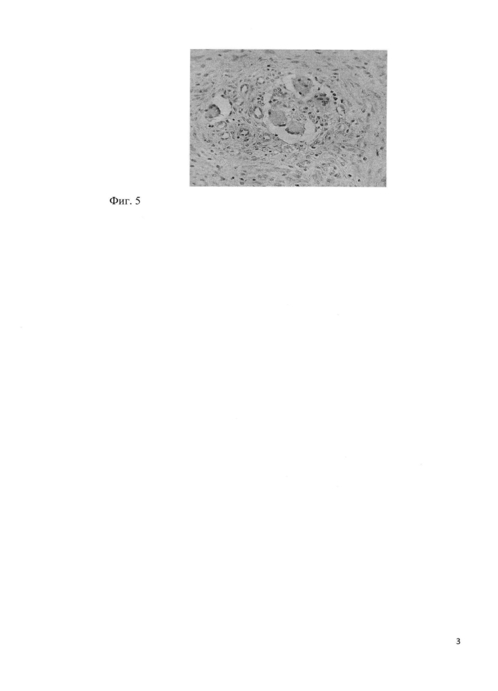 Способ моделирования туберкулеза женских половых органов (патент 2600926)