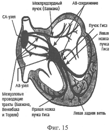 Способ определения электрической активности сердца (патент 2360597)