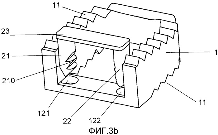 Позвоночное разделительное устройство с модульным креплением (патент 2344792)