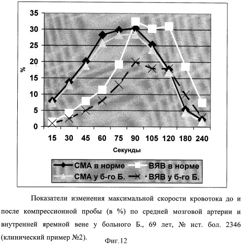 Способ диагностики ауторегуляции сосудов головного мозга (патент 2311133)