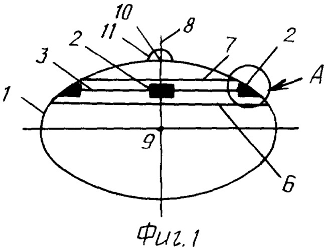 Устройство формирования опорно-двигательной культи для энуклеации при буфтальме глазного яблока (патент 2347545)