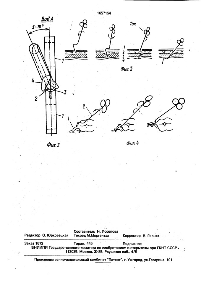 Манипулятор для комбинированной лапароскопии (патент 1657154)