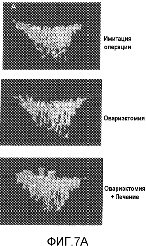 Лечение остеопороза (патент 2562976)