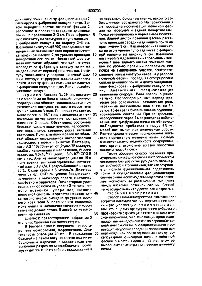 Способ лечения нефроптоза (патент 1690703)