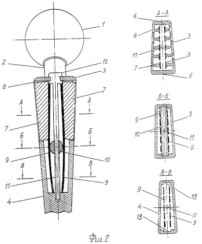 Эндопротез тазобедренного сустава (патент 2297202)