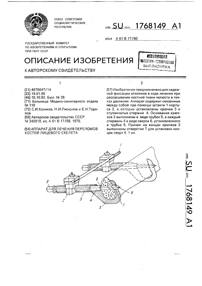 Аппарат для лечения переломов костей лицевого скелета (патент 1768149)